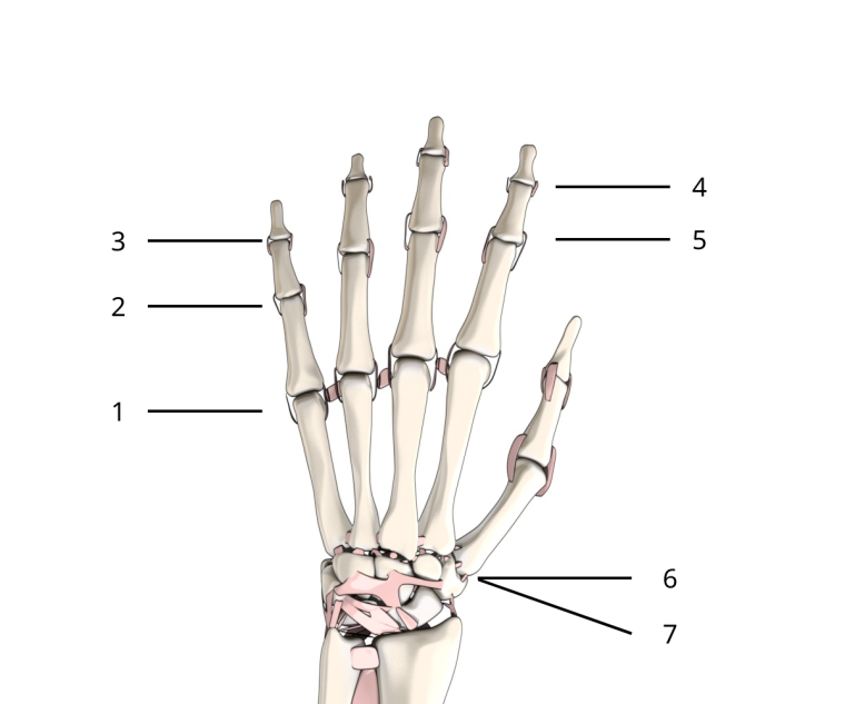 Osteoarthritis of the wrist